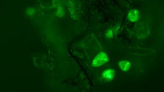 Fluorescence  Acridine Orange vs MitoTracker Green [upl. by Hallie]