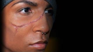 quotScarring Liquidquot Rigid Collodion [upl. by Comfort]