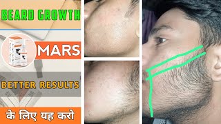 BEARD GROWTH □ Better results के लिए ये करो 🤫  Do this for better results  Mars by ghc [upl. by Muldon]