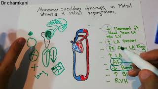 CVS physiology 235  Abnormal circulatory dynamics in Mitral stenosis and Mitral regurgitation [upl. by Elleron]