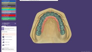 How to design screw retained implantAll on Four  Implant Bridge design with Exocad 30 [upl. by Castor636]