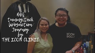 My tummy tuckBBLLiposuction journey by THE ICON CLINIC WITH Doc YAPPY [upl. by Annerol27]