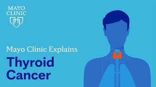 Mayo Clinic explains thyroid cancer [upl. by Brout]