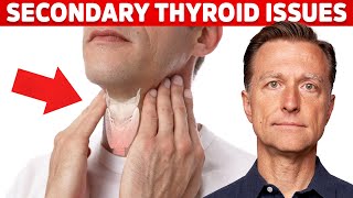 Most Thyroid Issues Are Secondary to Other Problems – Dr Berg [upl. by Lathan]