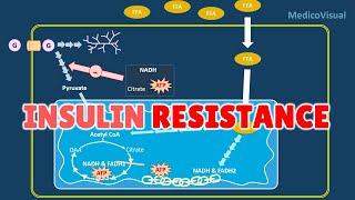 Insulin Resistance Part 2 Basal Lipolysis Free Fatty Acids and Randle cycle Hypothesis [upl. by Ahsikel]