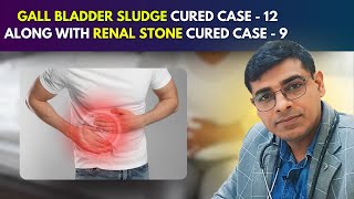 Gall Bladder Sludge Cured Case  12 Along With Renal Stone Cured Case  9  Dr Abhik Ghosh [upl. by Ojimmas]