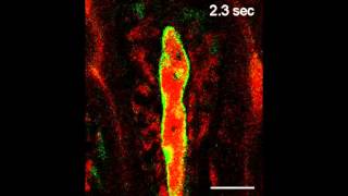 Realtime imaging of intestinal lacteals [upl. by Ayom]