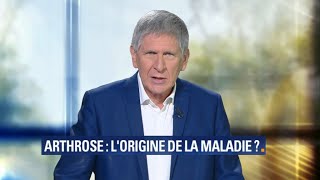 Arthrose connaissezvous l’origine de la maladie [upl. by Vary]