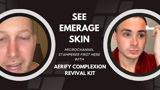 SEE EMERAGESKIN MICROCHANNEL STAMPERER FIRST HERE WITH AERIFY COMPLEXION REVIVAL KIT Dr Jason Emer [upl. by Stoops]