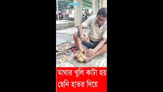 মাথার খুলি যে ভাবে মেডিকেল শিক্ষার্থীদের জন্য ছেনি হাতর দিয়ে কাটা হয়  Varendra Tv [upl. by Miun]