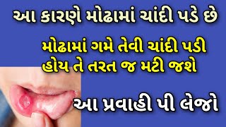 મોઢામાં ગમે તેવી ચાંદી પડી હોય તો પણ તરત જ મટી જશેઆ પ્રવાહી પી લેજો  મોઢામાં ચાંદી પડવાનું કારણ [upl. by Atsiuqal]