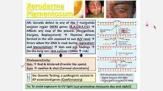 Xeroderma Pigmentosa CBL [upl. by Ramsdell]