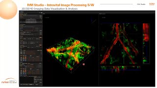 KR Webinar for ALLINONE INTRAVITAL MICROSCOPY [upl. by Eentruoc]