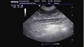 TROMBOSIS AORTA ABDOMINAL POR HIPER ADRENOCORTICISMO TAF [upl. by Brathwaite]