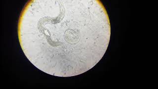 Plant parasitic Nematodes of apricotAphelenchus avenae p2 [upl. by Mcroberts]