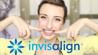 PARLONS PEU PARLONS DENTS  Les gouttières INVISALIGN ❁ [upl. by Nor]