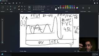 Pulmonology Pulmonary function tests Spirometry reversibility after bronchodilator provocative [upl. by Lunna]