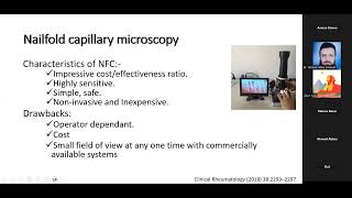 Nailfold capillaroscopy workshop day1 Dr Marwa Aboelmaaty Besar rheumatology amp immunology Mansoura [upl. by Ykvir299]