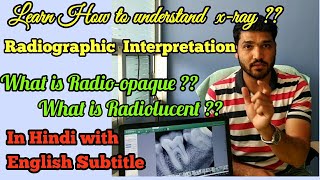 How to understand dental XRAY  Radiographic interpretation  dental radiograph [upl. by Ahtebat]