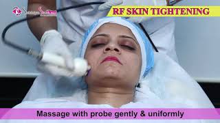 Radio Frequency RF Skin Tightening  Sakhiya Skin Clinic [upl. by Hill78]