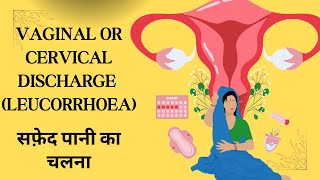 ALL ABOUT CERVICITIS सफ़ेद पानी आने की समस्या [upl. by Adihsaar]