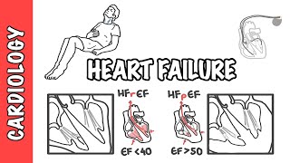 Heart failure with reduced and preserved ejection fraction pathophysiology and treatment [upl. by Ilan165]