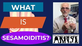 What Is Sesamoiditis [upl. by Ennayehc]