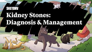 Kidney Stones Overview Diagnosis amp Management Part 1  Sketchy Medical  USMLE Step 2 CK [upl. by Kono330]