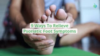 9 Ways To Relieve Psoriatic Foot Symptoms [upl. by Brunhilde783]