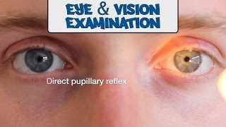 Examination of the Eyes and Vision  OSCE Guide old version  UKMLA  CPSA [upl. by Akima]