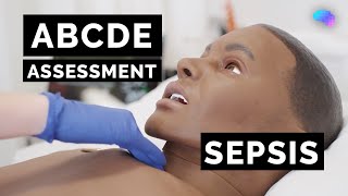 ABCDE Assessment  Sepsis  Emergency Simulation Scenario  OSCE Guide  UKMLA  CPSA [upl. by Adai]