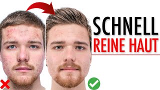 Schnell reine Haut bekommen ● Reine Haut Tipps [upl. by Rivy]