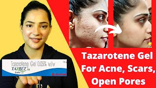 How to remove scars  Scar creams  Tazaroten Gel  Tazret Gel 005 Review  Tazaroten Cream 01 [upl. by Baillie59]