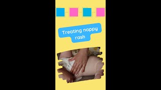 👶💦 Nappy rash types causes treatment amp prevention [upl. by Aehsan]