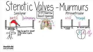 Heart Murmurs and Valve Disease Heart Murmur Series [upl. by Nnylirej]