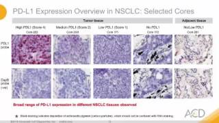 Surveying Expression of Immune Checkpoint Markers in the Tumour Microenvironment [upl. by Seravart]