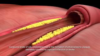 Lactobacillus plantarum INDUCIA [upl. by Haimirej]