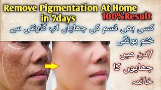 How To Remove Pigmentation From Face Naturally  Pigmentation Kaise khatam Karen in 7 Days [upl. by Lebisor]