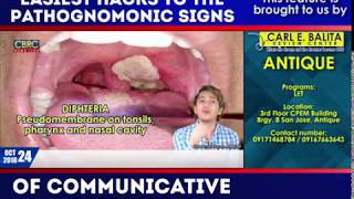 Pathognomonic Signs in Communicable Disease Part 1 by Janus de Leon [upl. by Waynant]