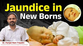 Jaundice in Newborns  DrParijat Ram Tripathi  Ankura Hospitals Hyderabad [upl. by Lunn]