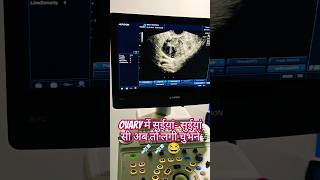 Ovum Pick Up At Sehat Hospital Burhanpur  IVF मैं अंडे कैसे निकाले जाते हैं drshubhipatil [upl. by Aleris]