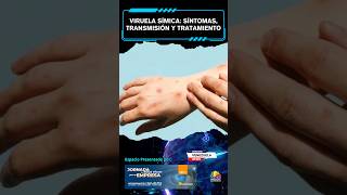 🚨🌎  UltimaHora OMS  Viruela símica síntomas transmisión y tratamiento [upl. by Bello]