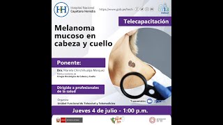 Melanoma mucoso en cabeza y cuello [upl. by Schapira]