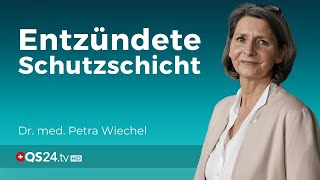 Schleimhautentzündungen  Ein Hinweis auf stille Entzündungen  Dr med Petra Wiechel  QS24 [upl. by Helprin18]