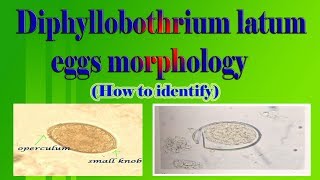 Diphyllobothrium latum eggs morphology How to identify [upl. by Aihsital]