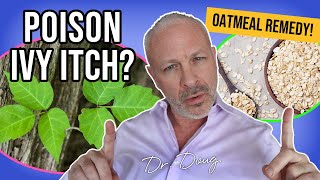 POISON IVY Remedy Oatmeal  Dr Doug Willen [upl. by Bethel]