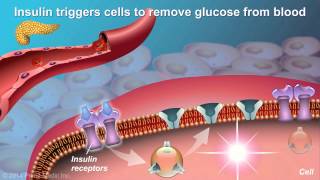 Understanding Type 2 Diabetes [upl. by Knowles]