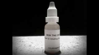 Skin Tag Remover  removing skin tags the natural way Skin Tag Zap [upl. by Ritter]