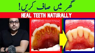 Dr ZeeNatural Remedy for dental Plaque Cavities and Gingivitis [upl. by Parent]