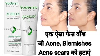 Yuderma Acnelex Medi Acne Face Wash amp Face Mask Full Honest Review  क्या हुआ जब मैंने यूज किया [upl. by Isied508]